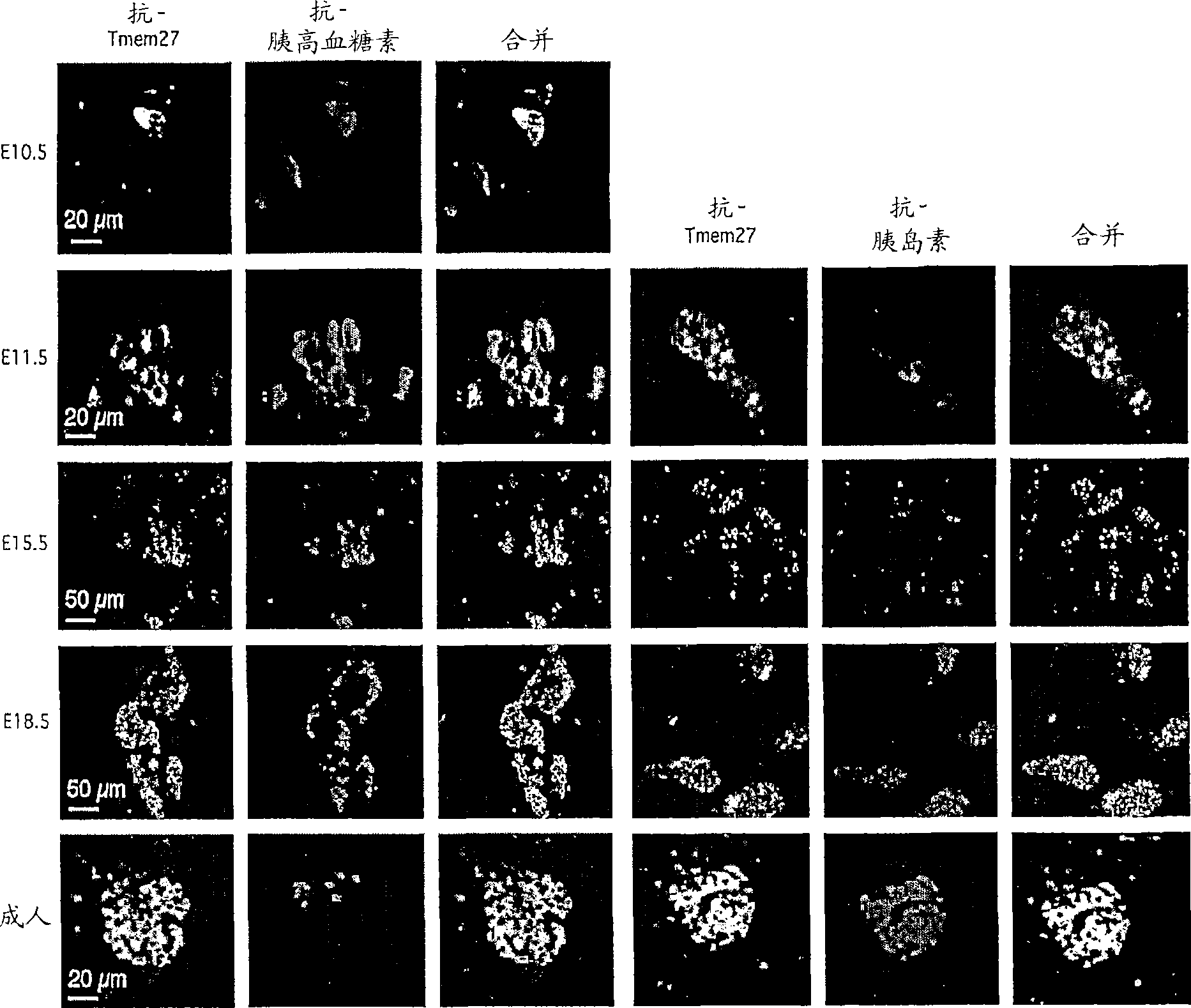 Stimulation of pancreatic Beta cell proliferation