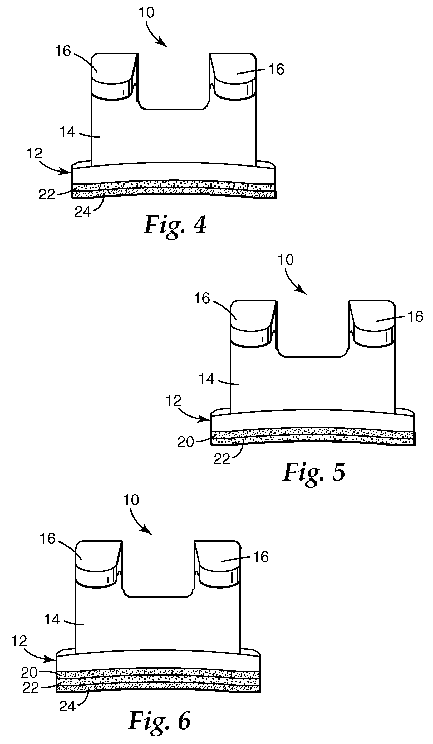 Dental compositions including radiation-to-heat converters, and the use thereof