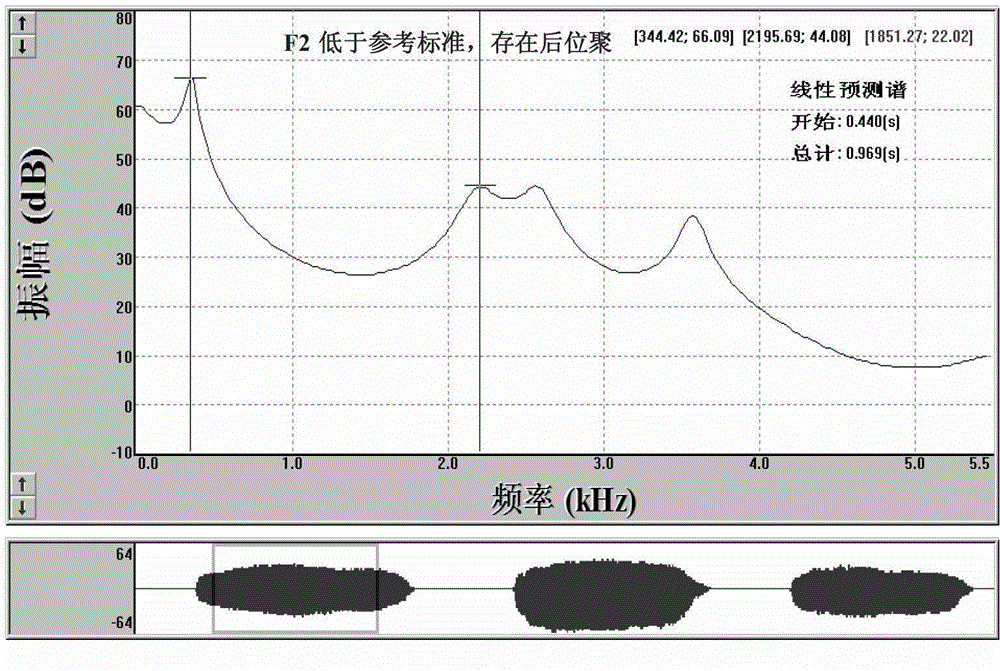 Rehabilitation system and method based on real-time audio-visual feedback and promotion technology for speech resonance