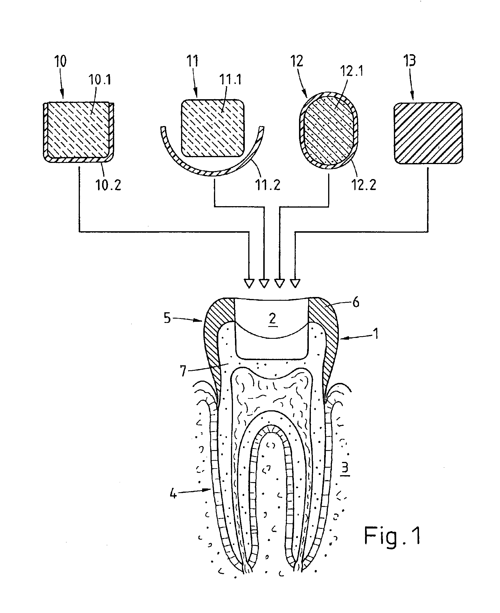 Preparation for being fastened on a natural tooth part or tooth and corresponding fastening method