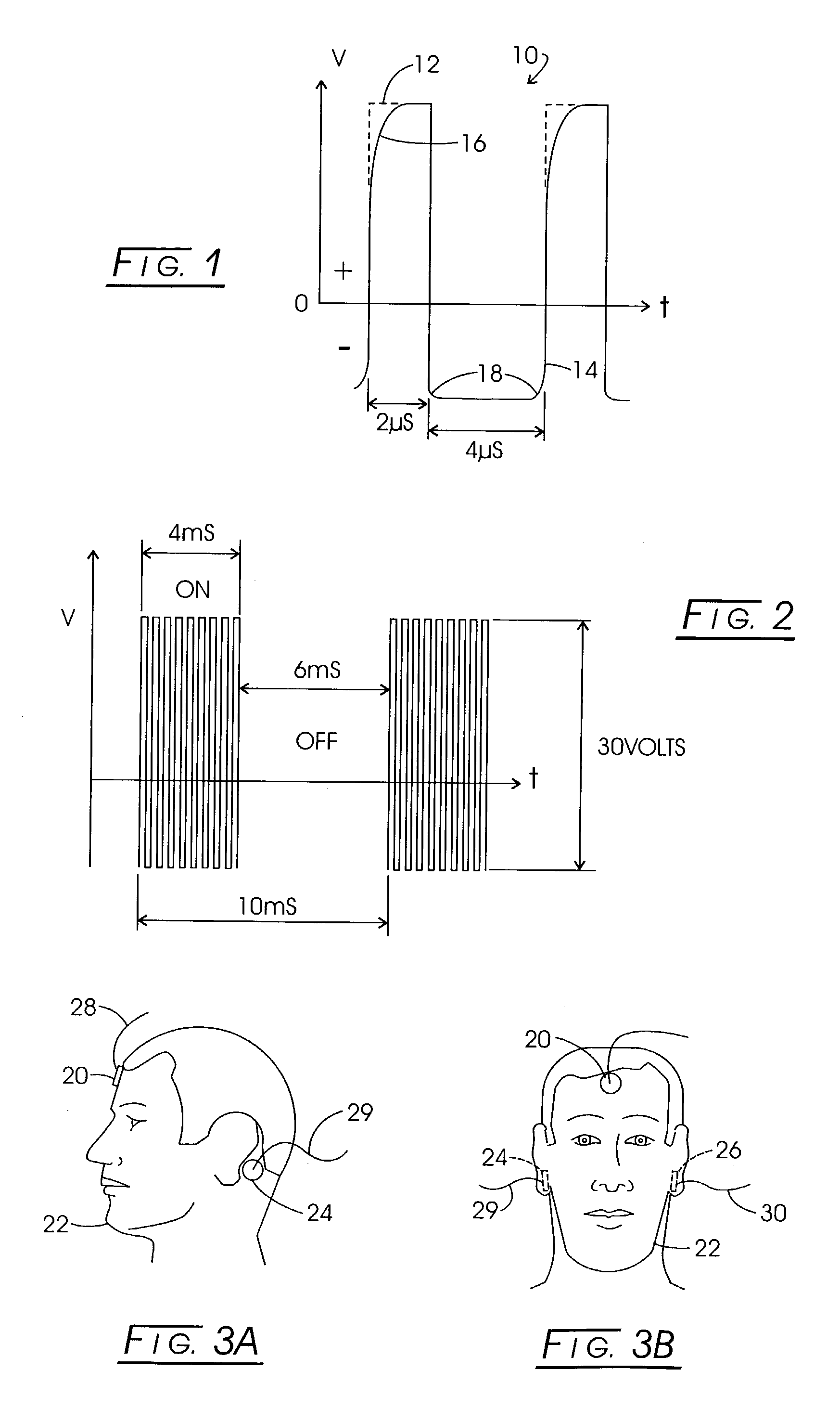 Electrical stimulation of tissue for therapeutic and diagnostic purposes