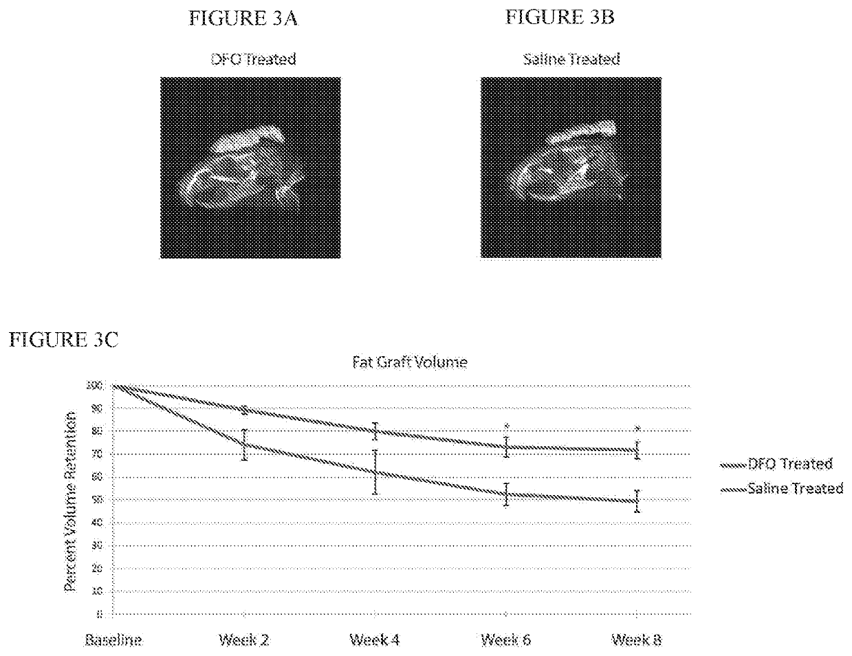 Conditioning irradiated tissue for increasing vascularity