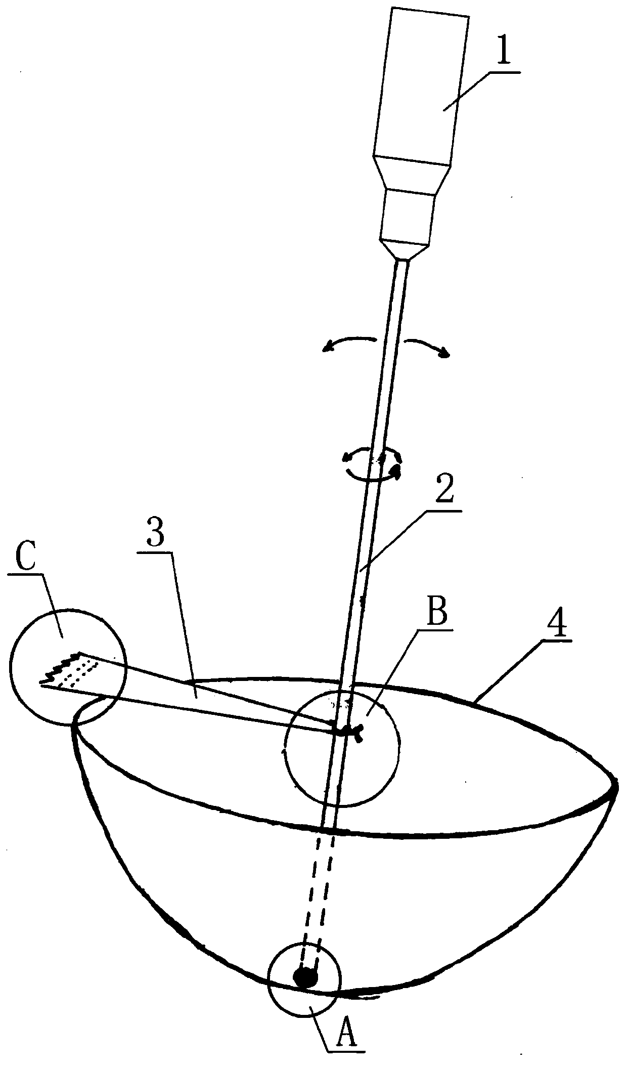 Electric acetabular osteophyte excider