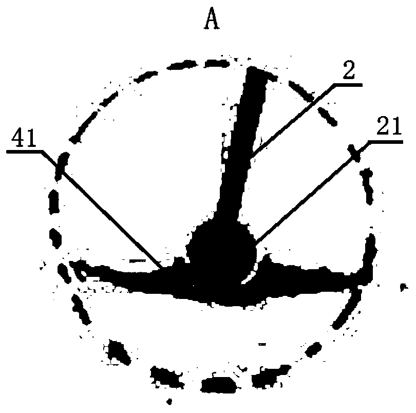 Electric acetabular osteophyte excider