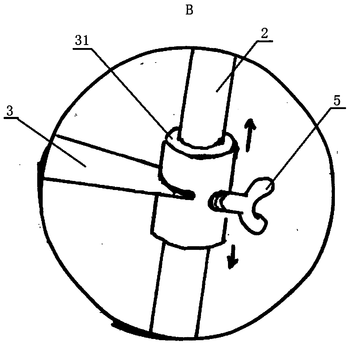 Electric acetabular osteophyte excider