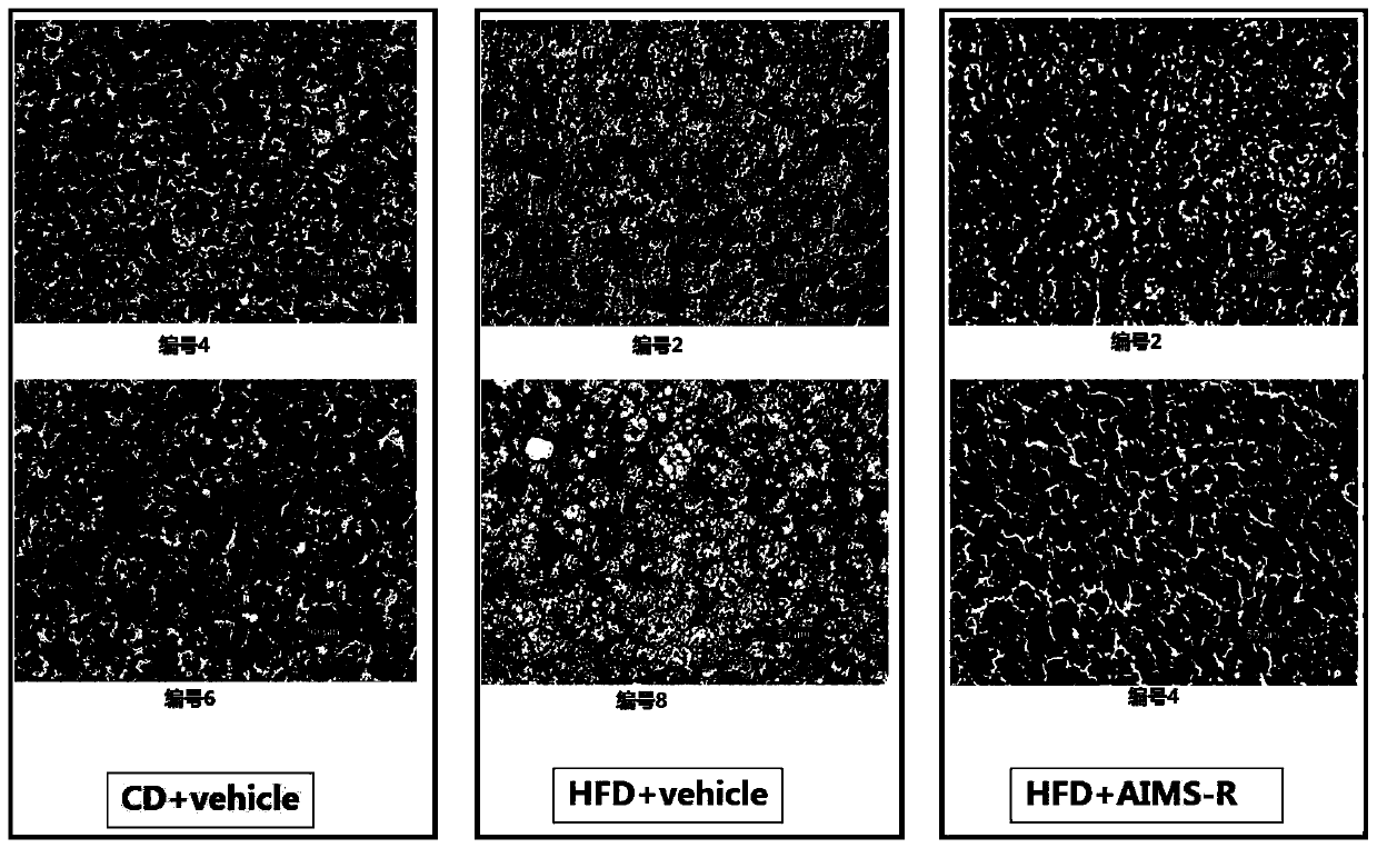 Application of ripterol and its derivatives in the preparation of products for the prevention and/or treatment of fatty liver