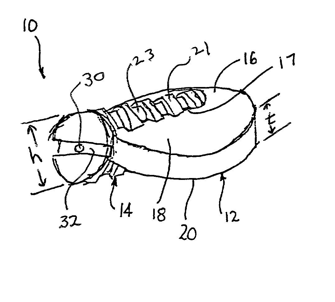 Anterior lumbar spacer