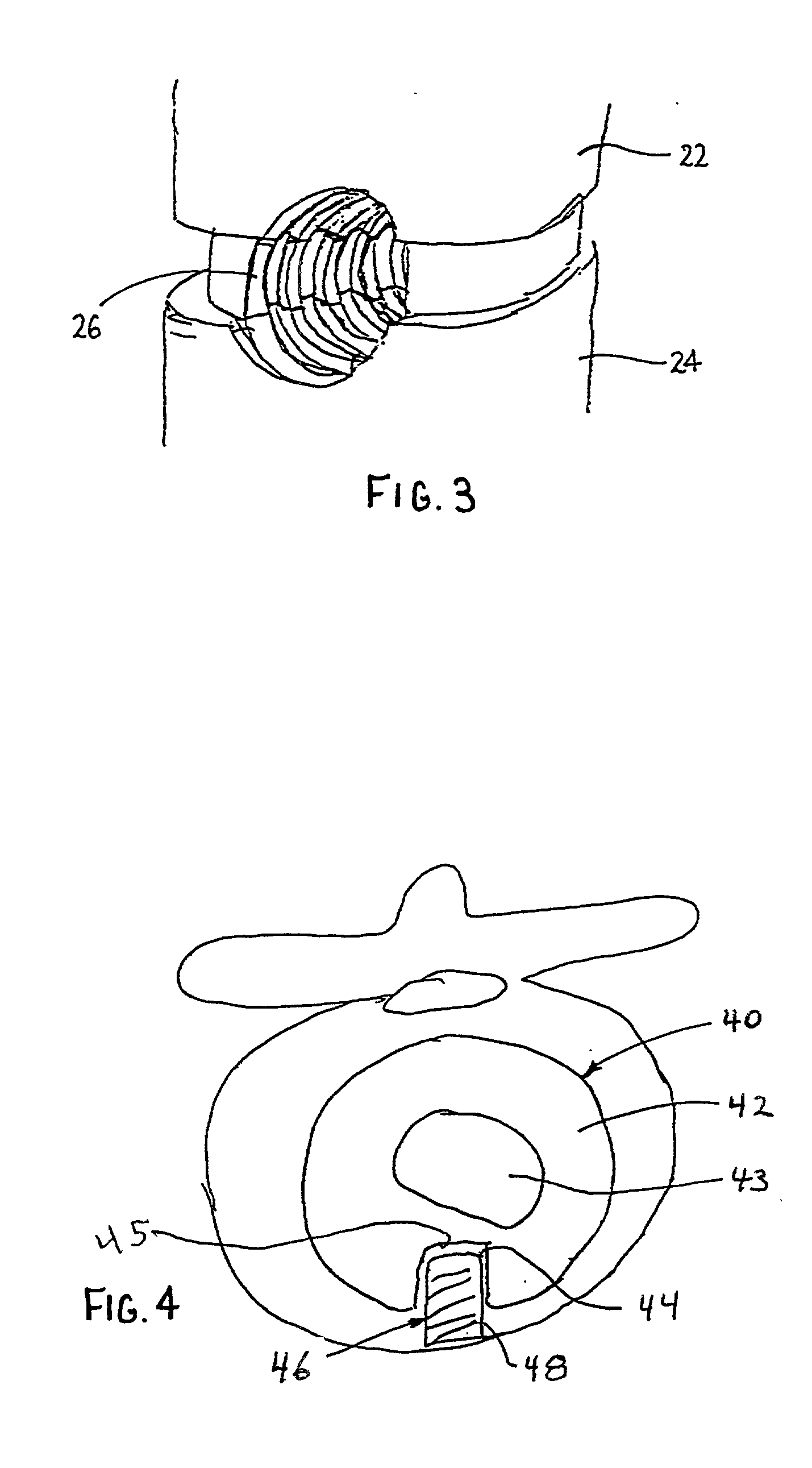 Anterior lumbar spacer