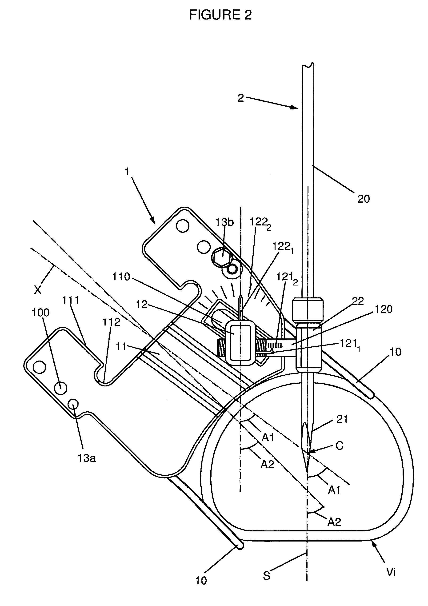 Instrumentation and methods for inserting an intervertebral disc prosthesis