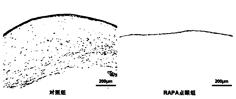 A kind of rapamycin nano micellar eye drops and preparation method thereof