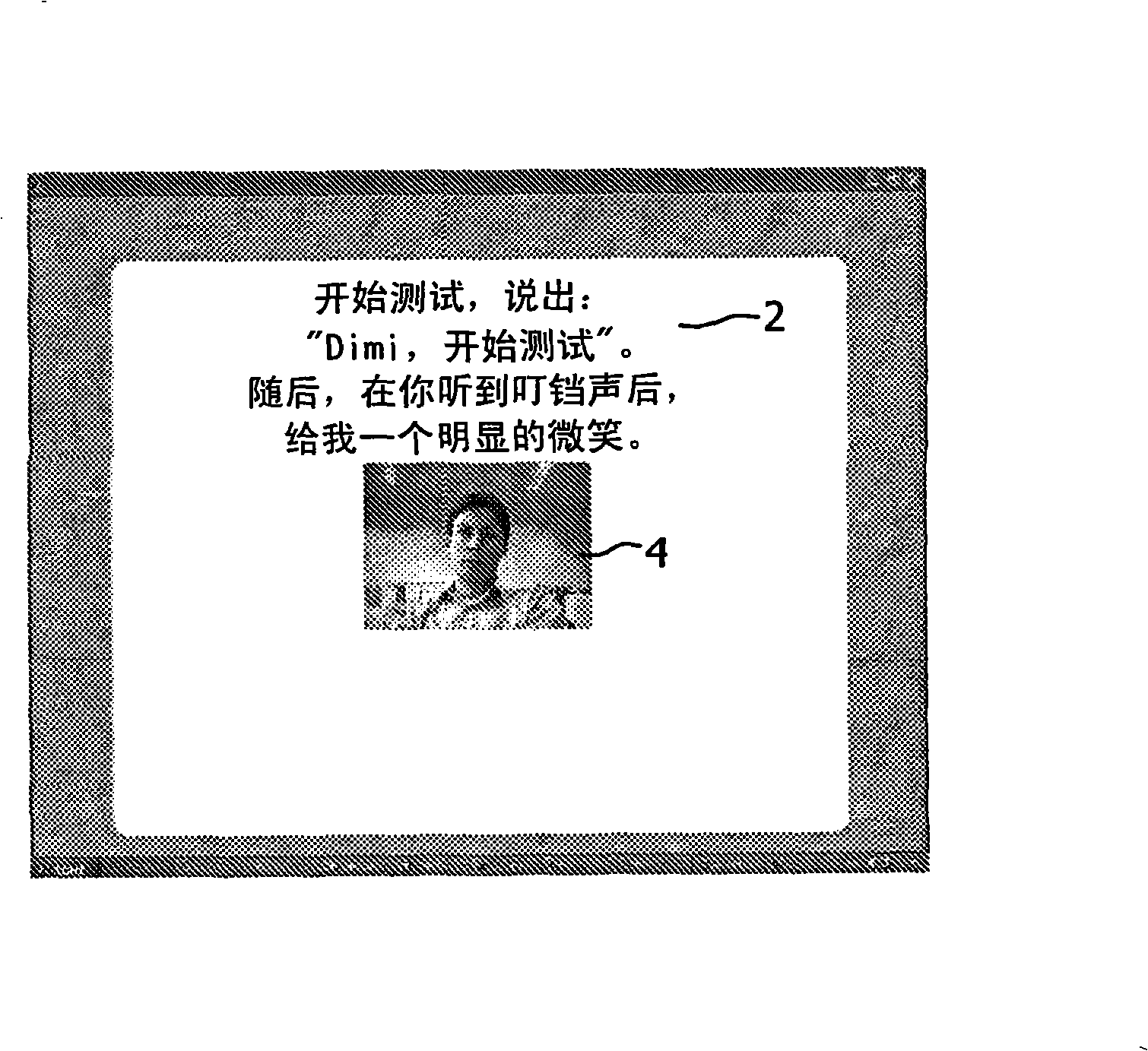 Computer-based facial paralysis assessment