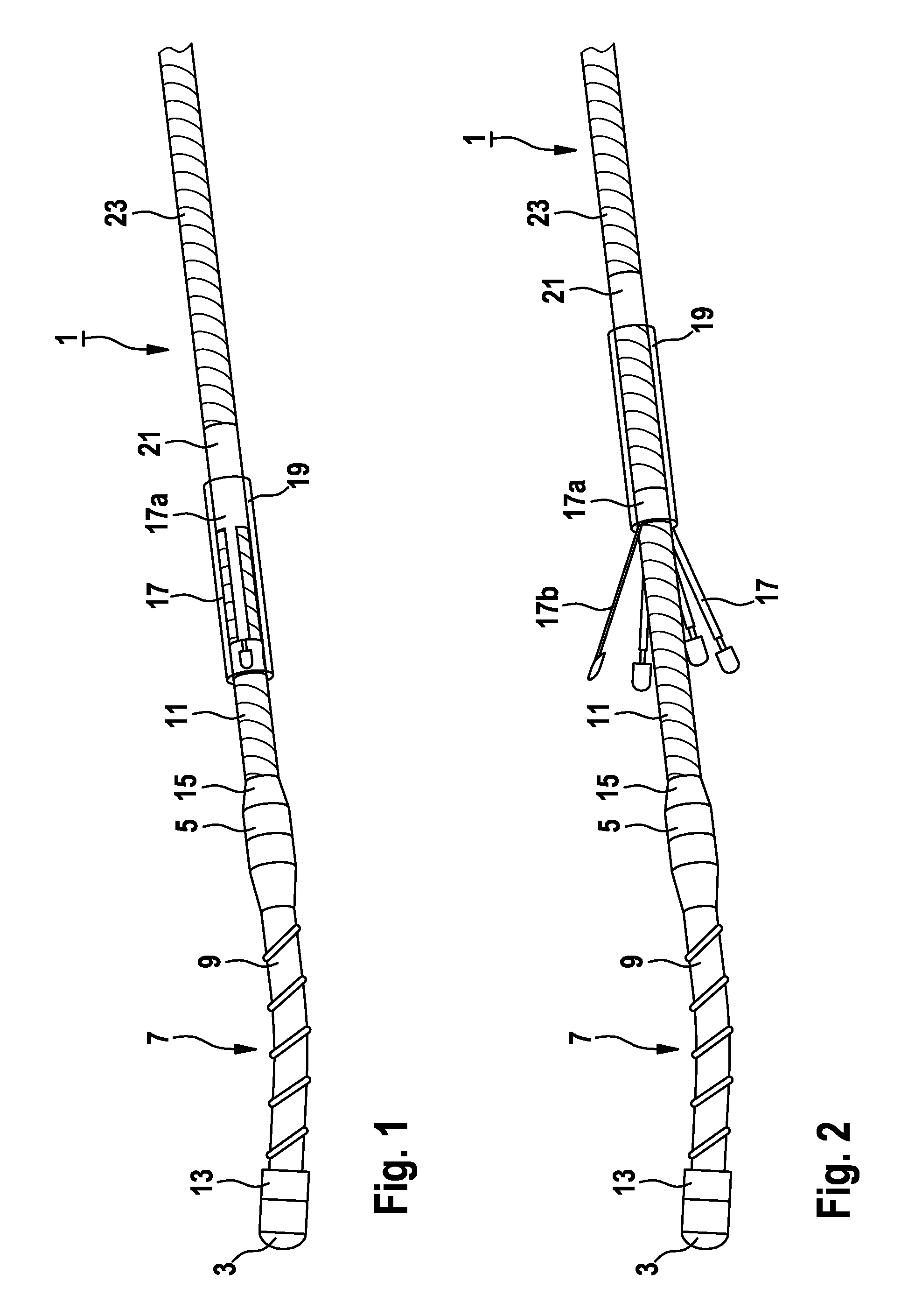 Implantable catheter lead or electrode lead