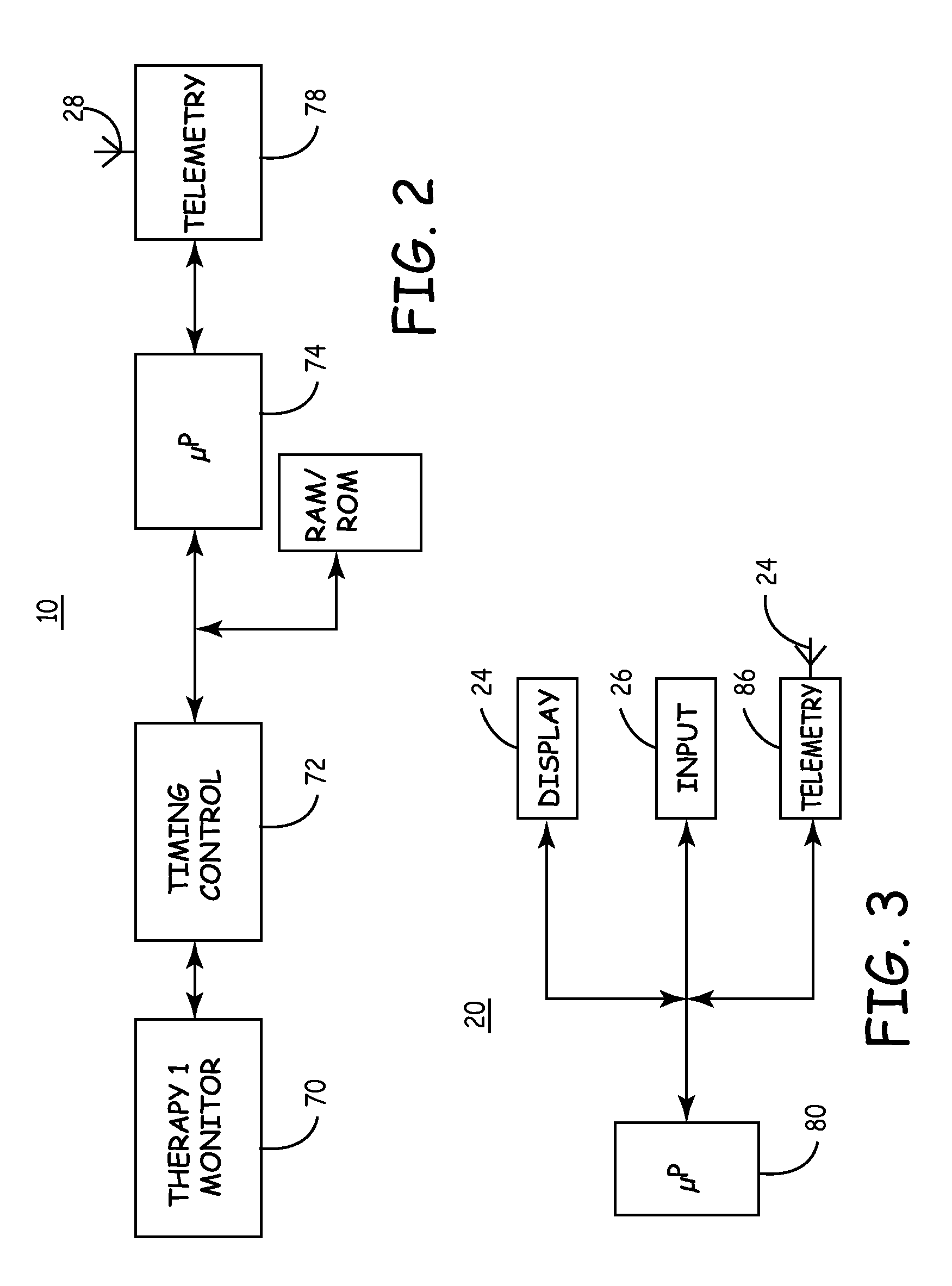 Implantable medical device package antenna