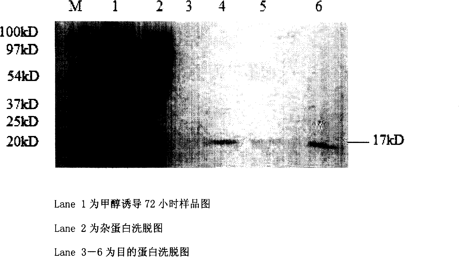 Expressing method of human interleukin 7 in eucaryon host