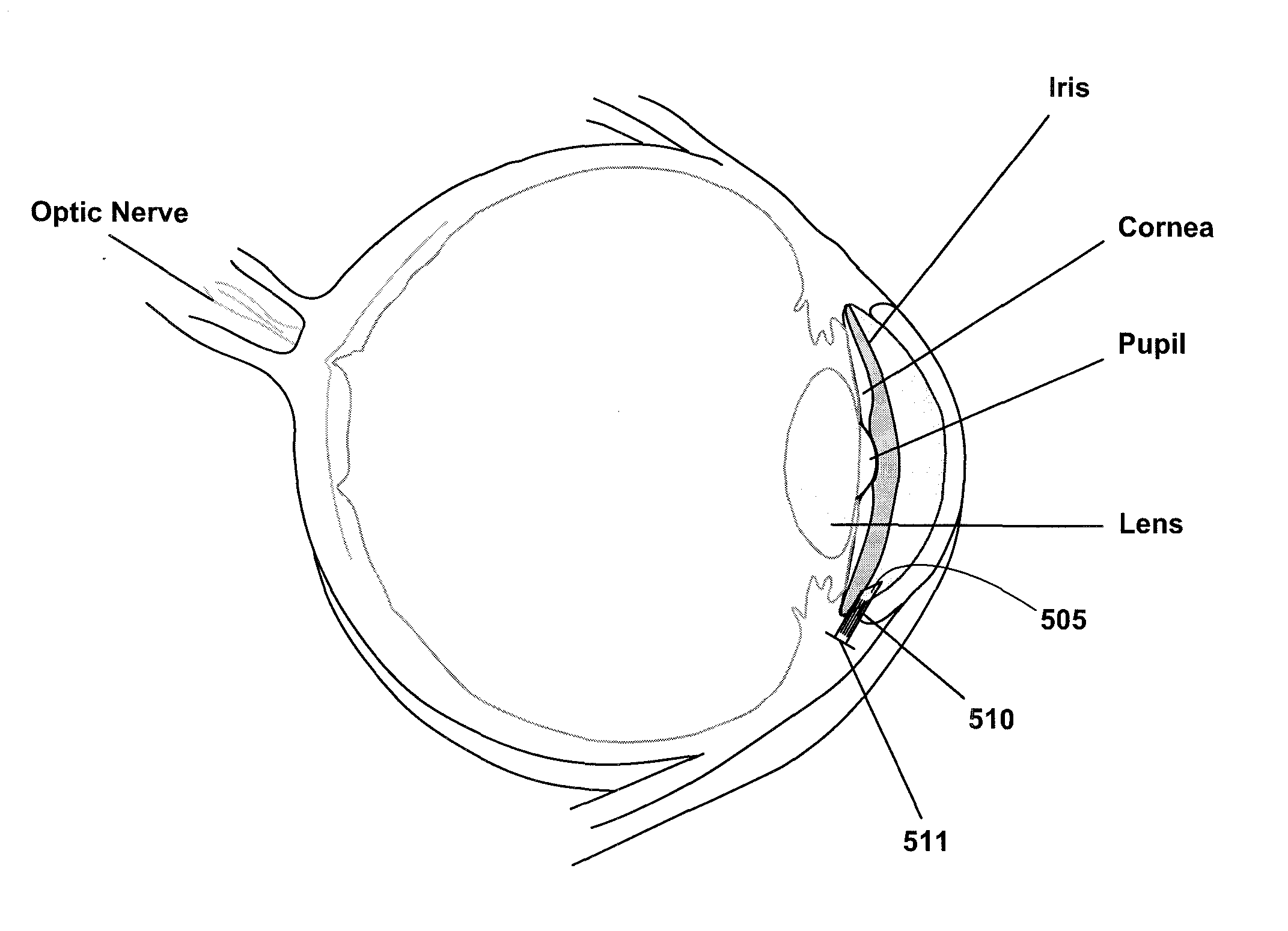 Ocular filtration devices, systems and methods