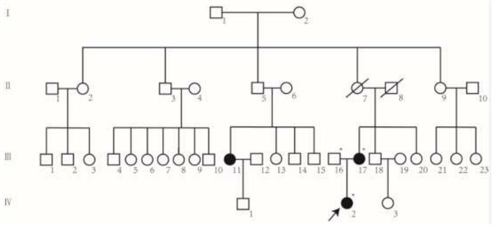 Mutant N4BP2 gene related to non-syndromic cleft lip and palate and application thereof