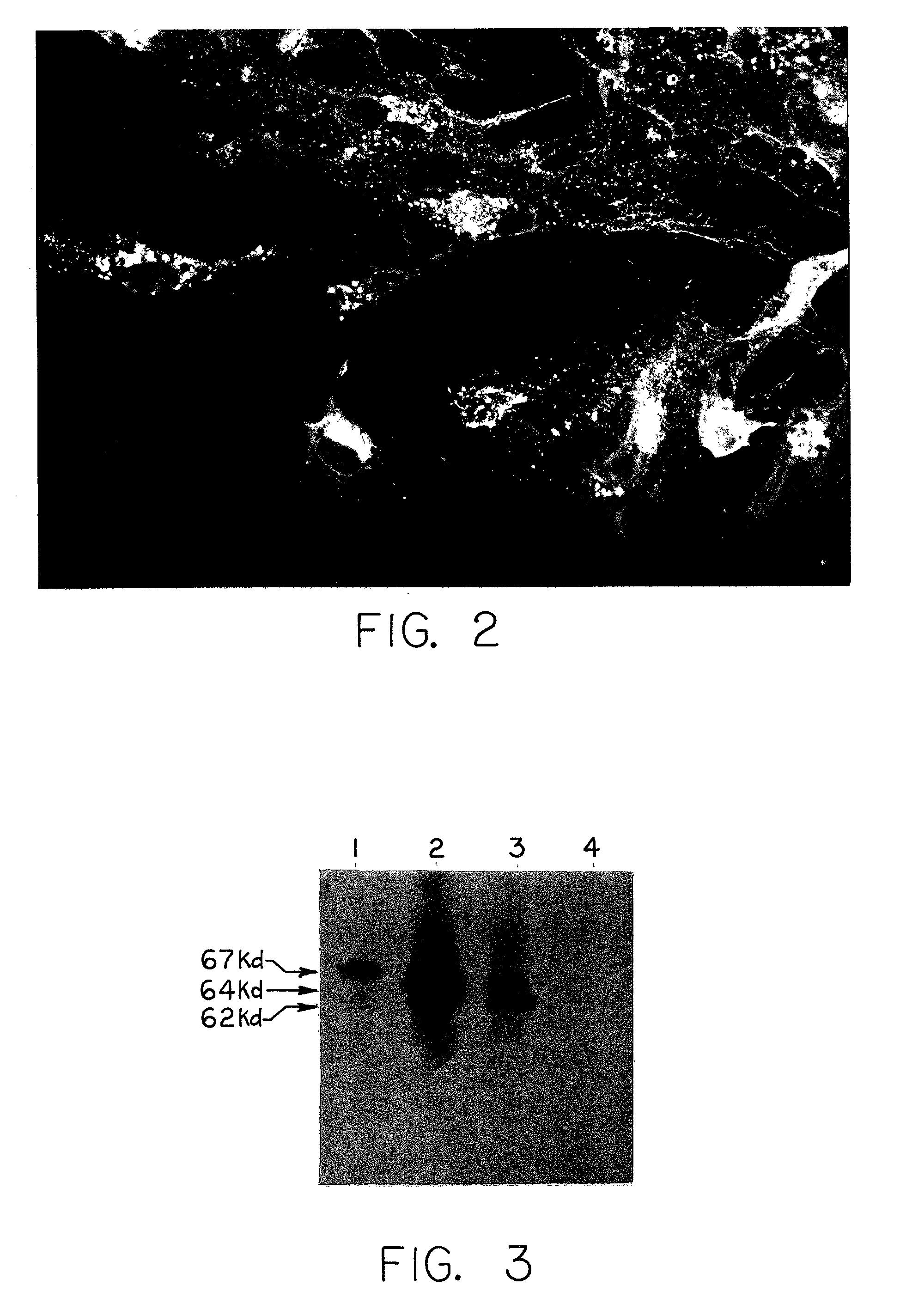 Recombinant multivalent viral vaccine