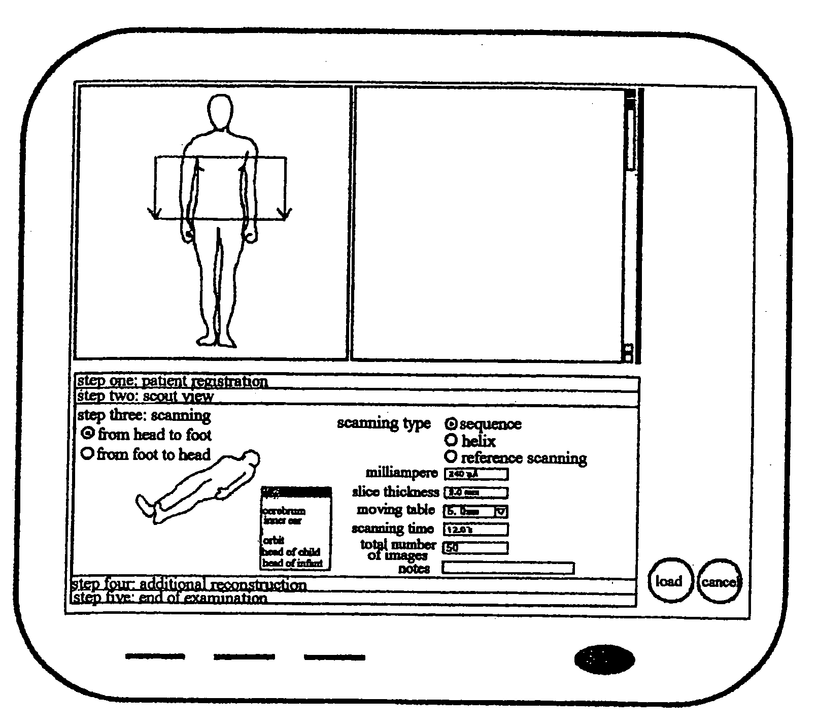 Operating method implemented through a user interface for a computed tomography examination