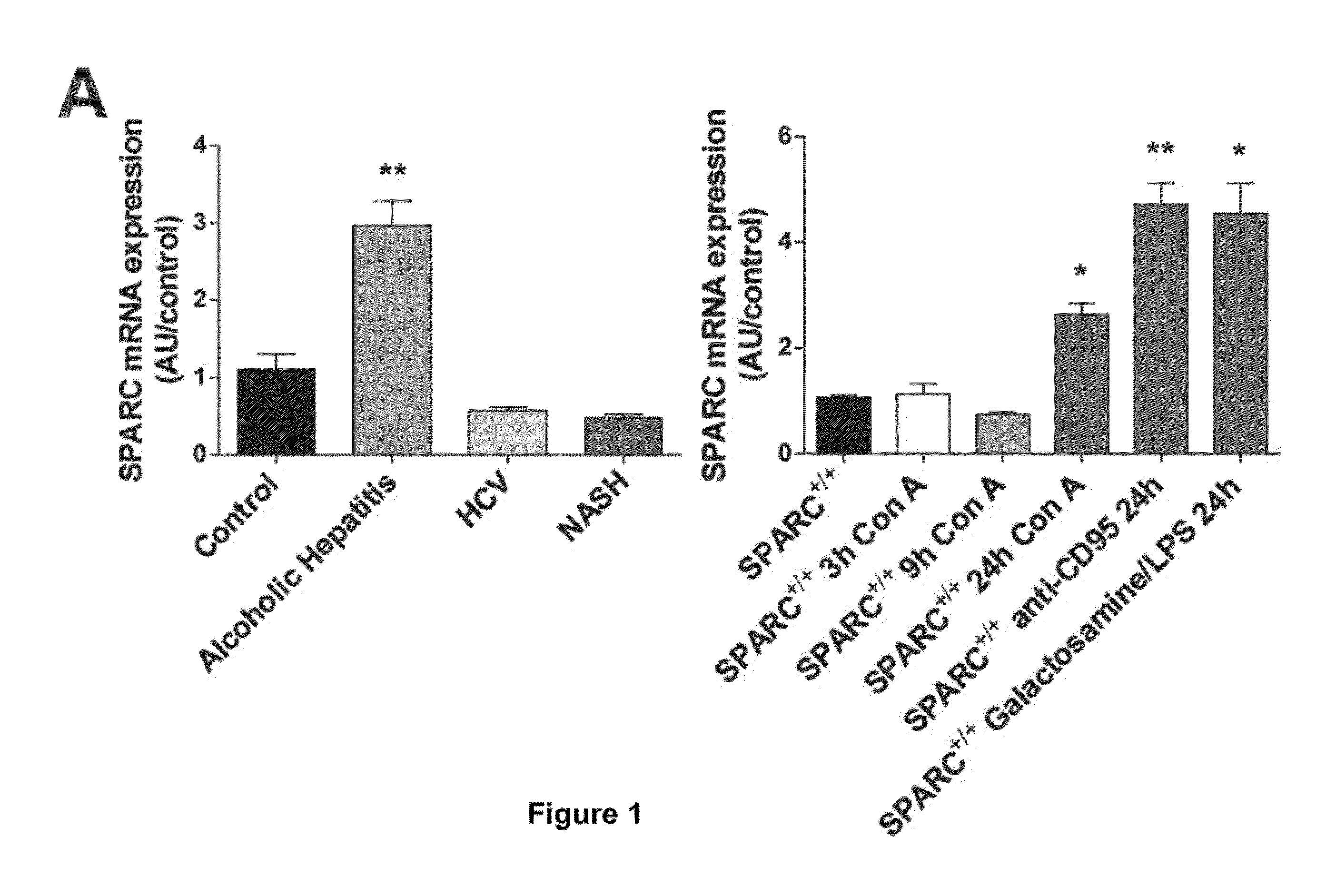 SPARC (Secreted Protein, Acidic and Rich in Cysteine), A New Target for the Treatment and Prevention of Acute Liver Failure