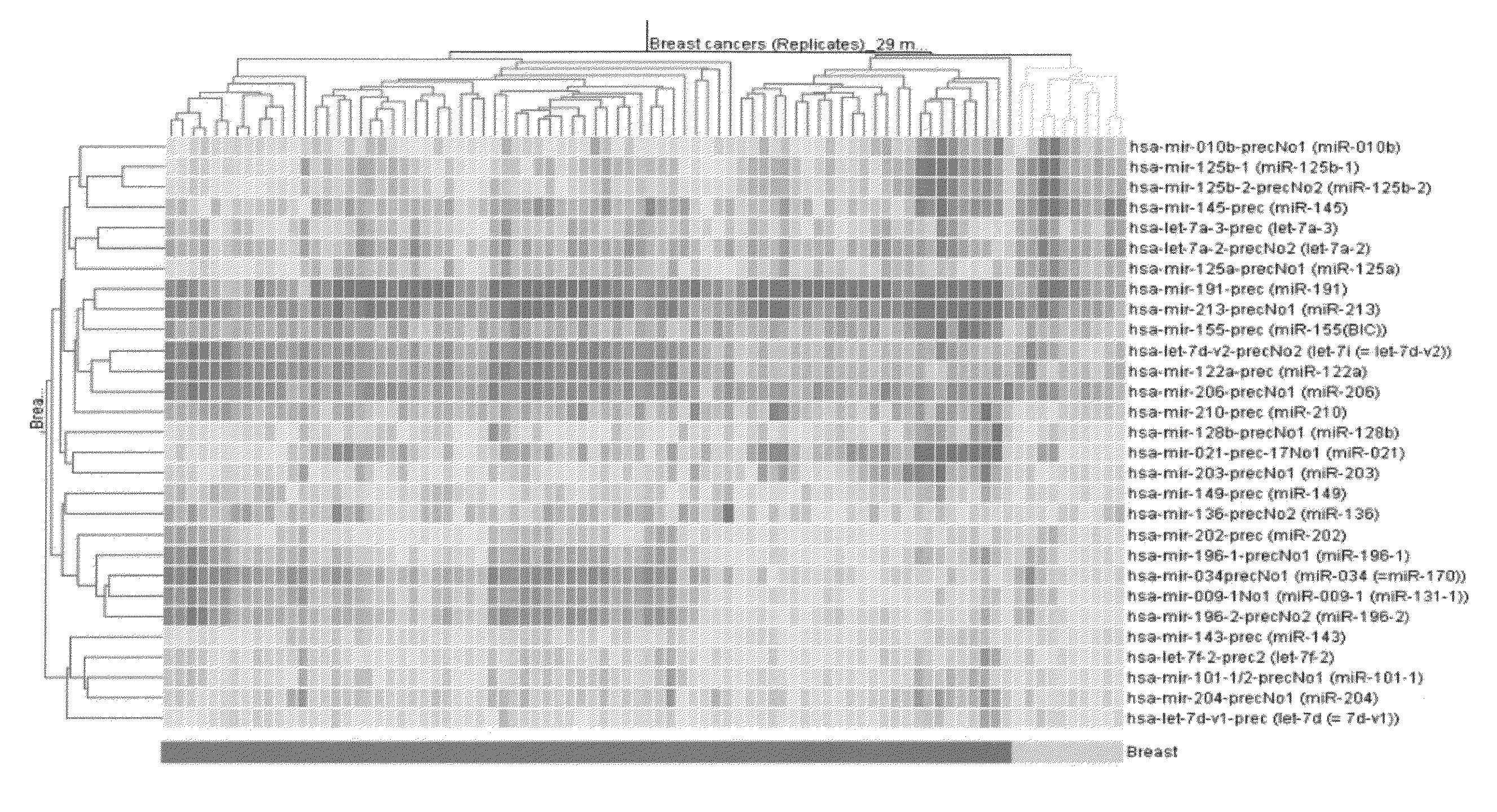 MicroRNA-based methods and compositions for the diagnosis, prognosis and treatment of breast cancer