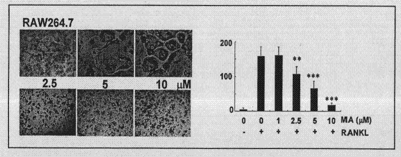 Use of crataegolic acid and derivatives thereof in preparation of therapeutic and/or preventive medicines for inhibiting osteoclast differentiation and function