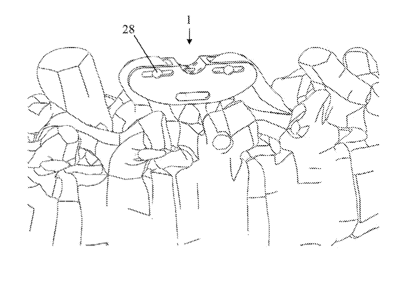 Dynamic Inter-Spinous Process Spacer