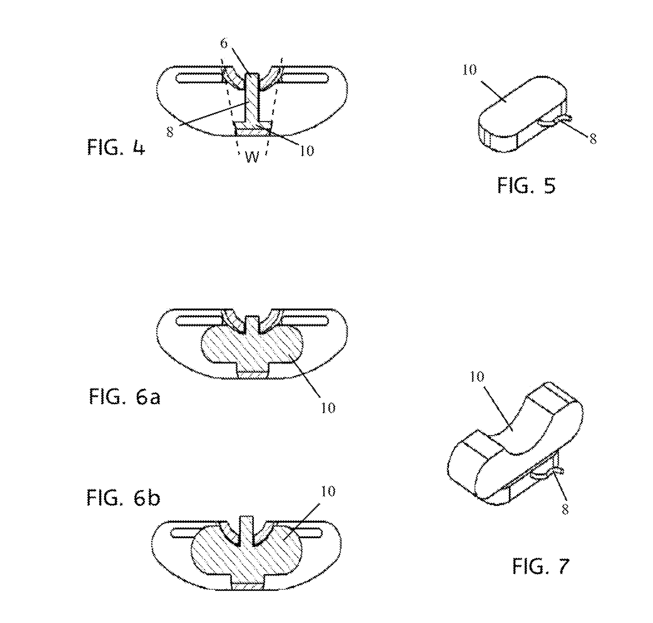 Dynamic Inter-Spinous Process Spacer