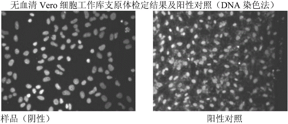 Method for preparing rabies vaccine stock solution from serum-free Vero cells and serum-free rabies vaccine product