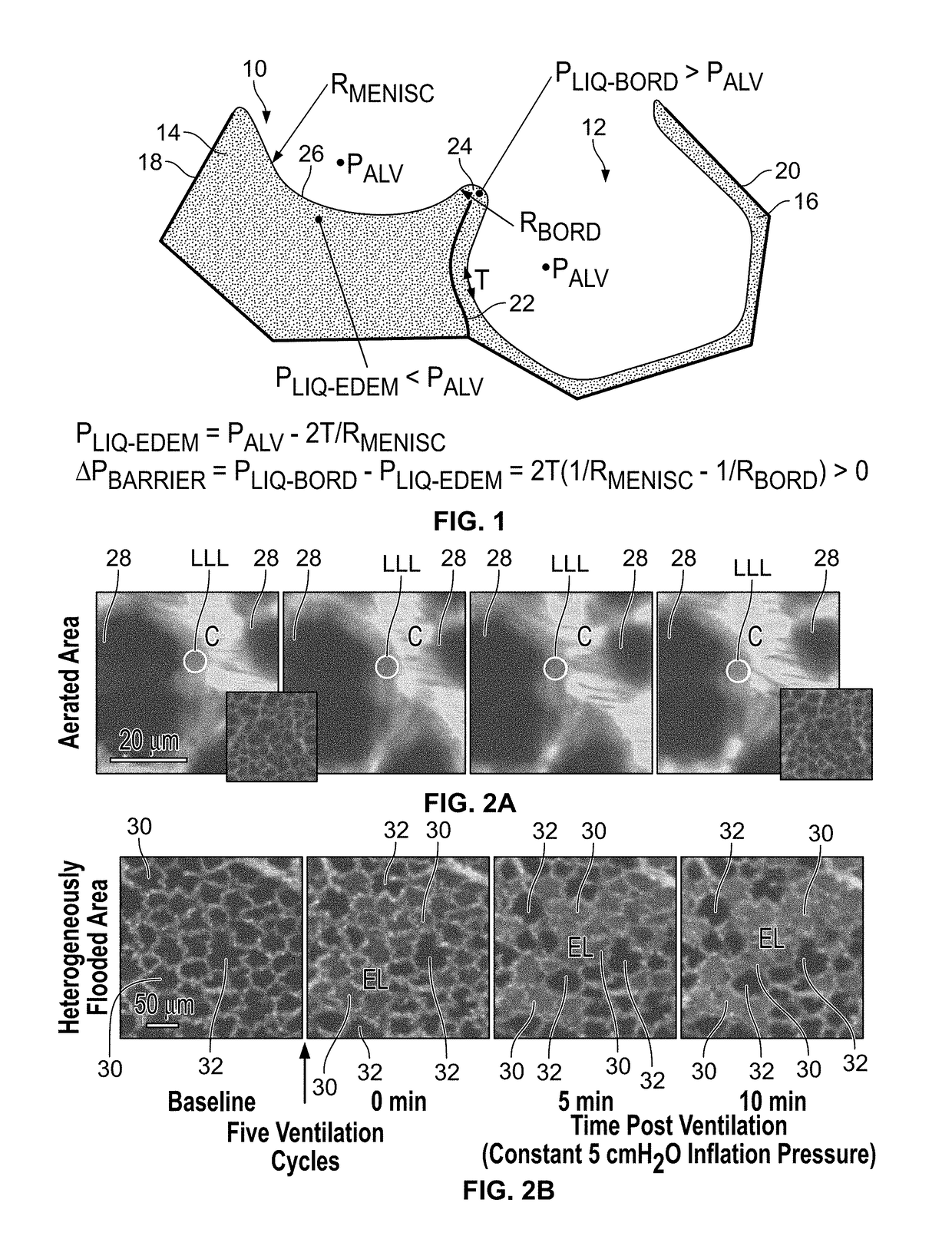 Use of rhodamine dyes to reduce alveolar surface tension