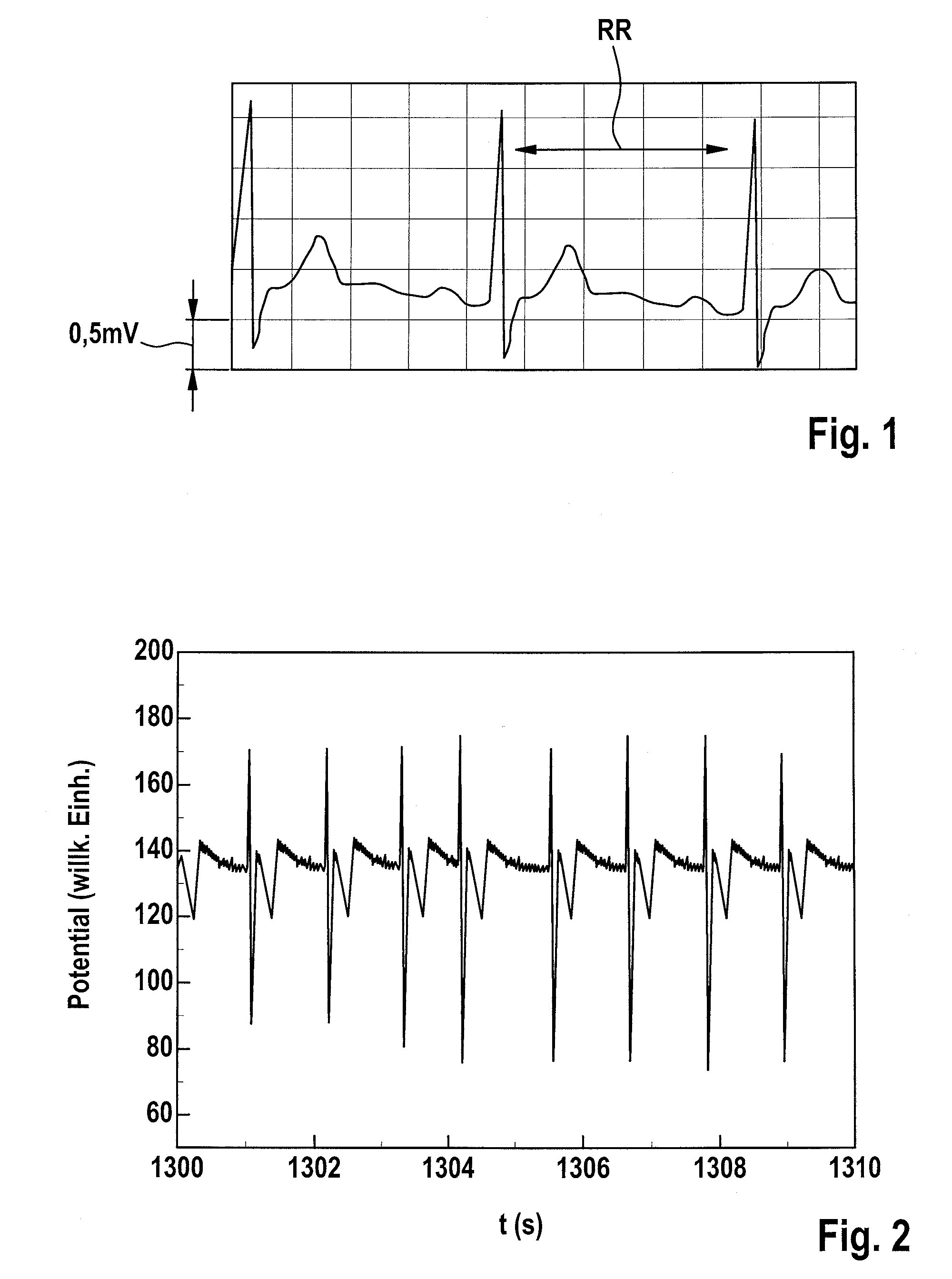 Diagnosis of sleep apnea