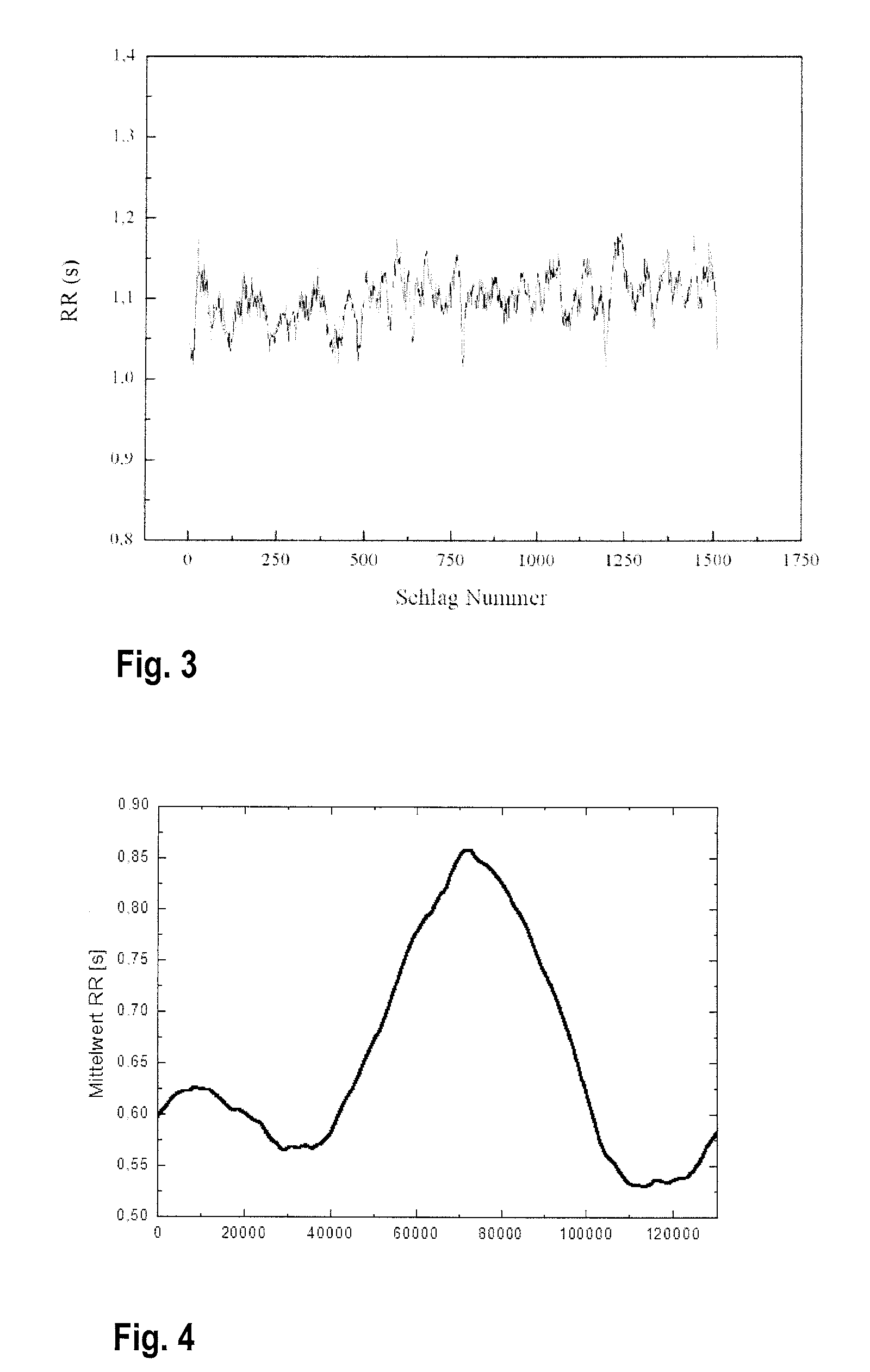 Diagnosis of sleep apnea