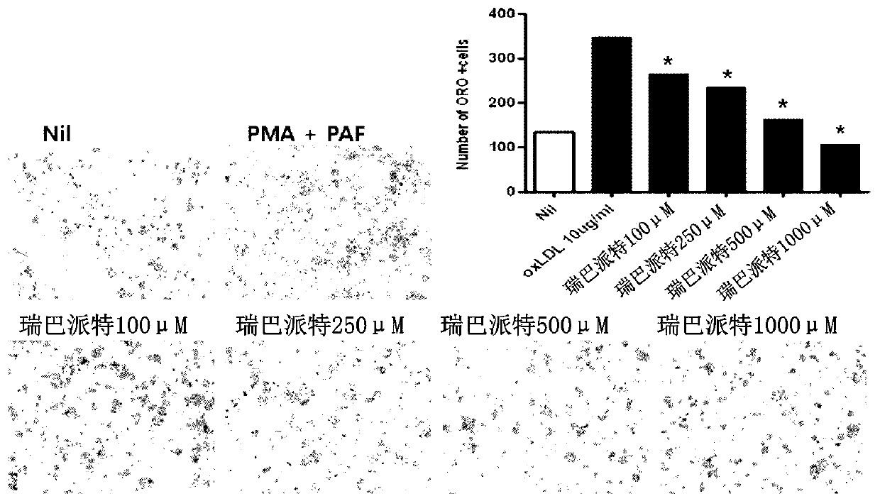 Composition for prevention or treatment of hyperlipidemia and related diseases containing rebamipide as an active ingredient