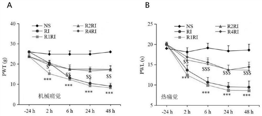 Application of remimazolam in treatment of opioid-induced postoperative hyperalgesia