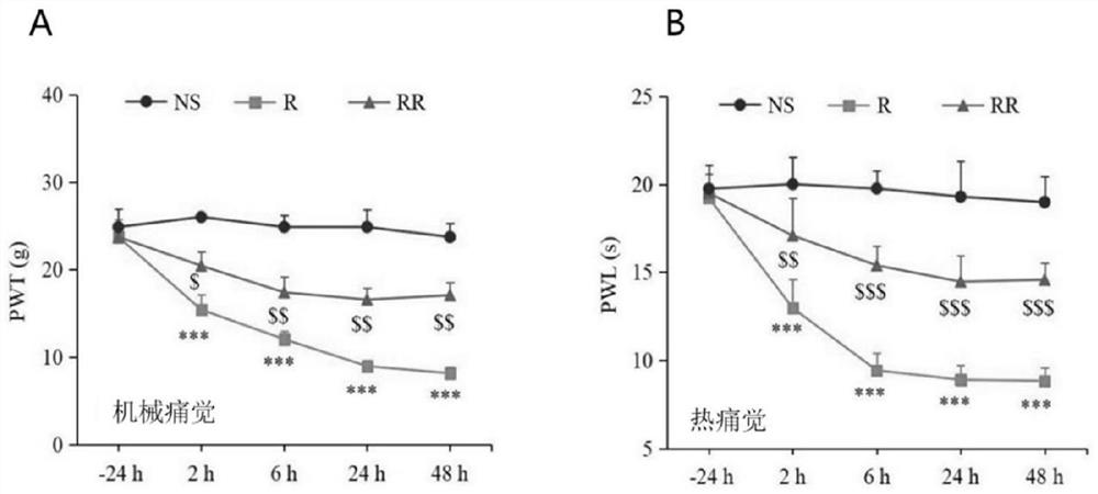 Application of remimazolam in treatment of opioid-induced postoperative hyperalgesia