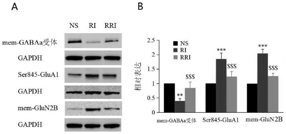 Application of remimazolam in treatment of opioid-induced postoperative hyperalgesia