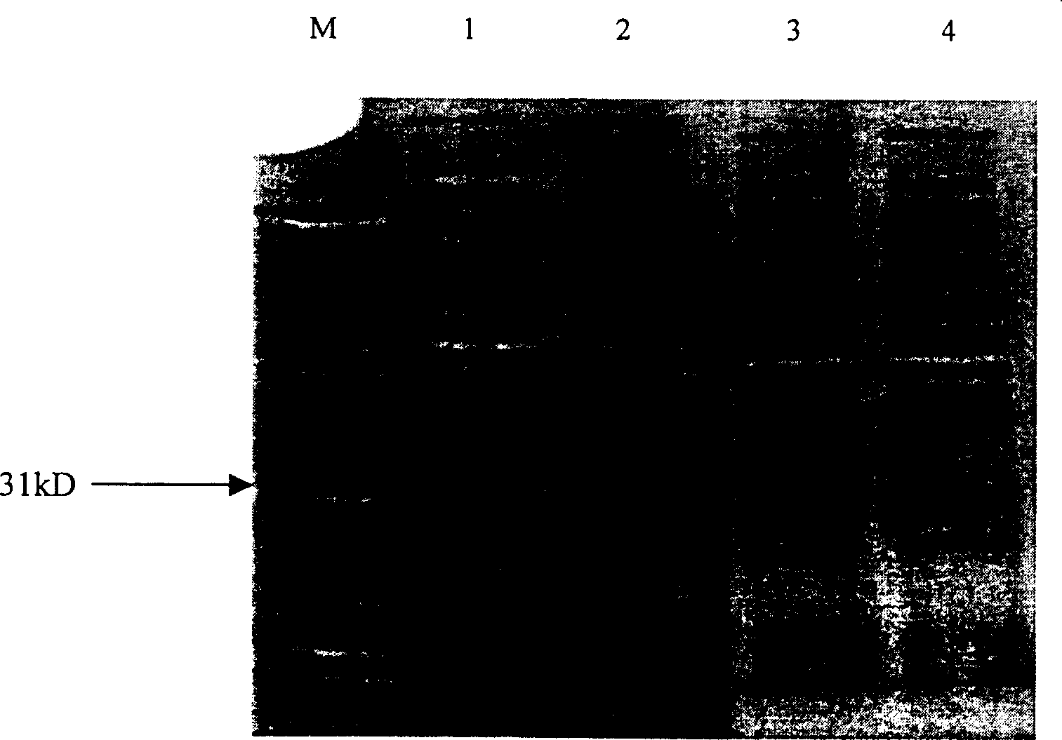 GST fusion expression of conotoxin MVII A gene and its use