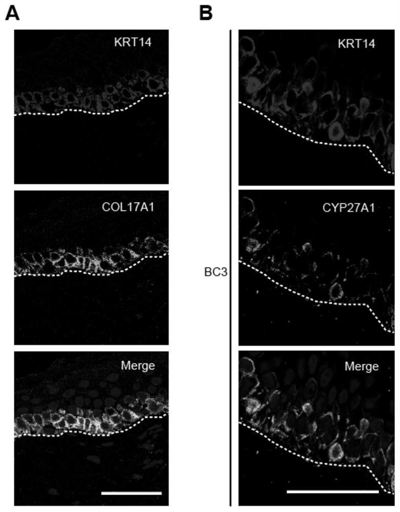 Molecular marker for human skin aging and regulation target and application thereof