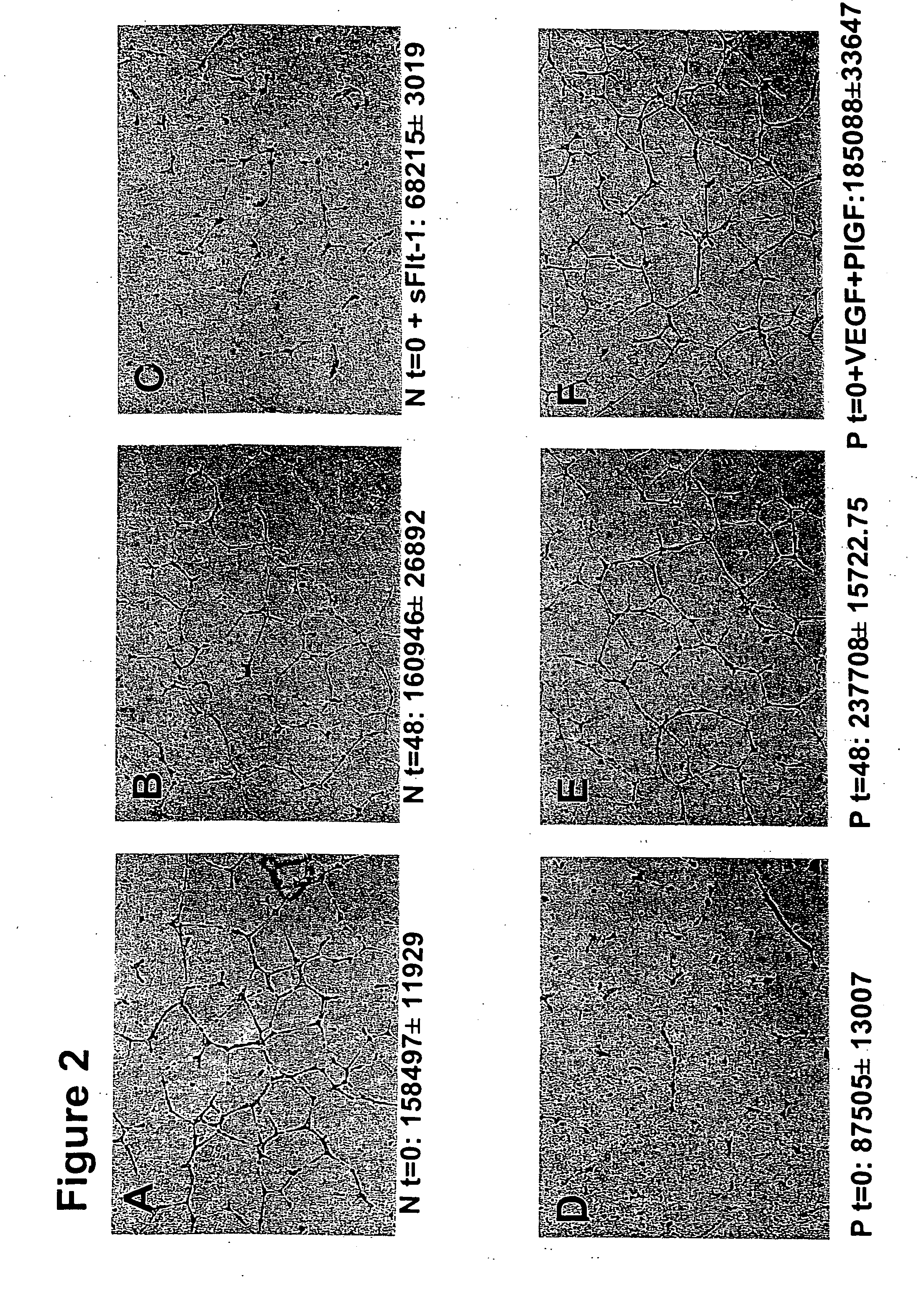 Methods of diagnosing and treating pre-eclampsia or eclampsia