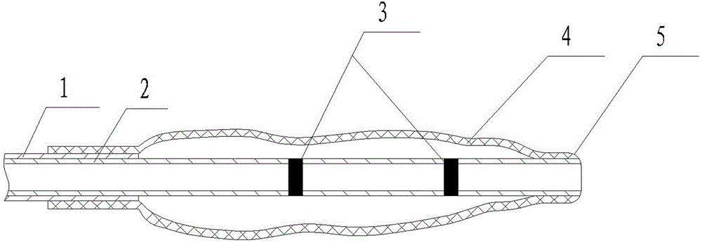 Special-shaped vertebral body expansion balloon catheter