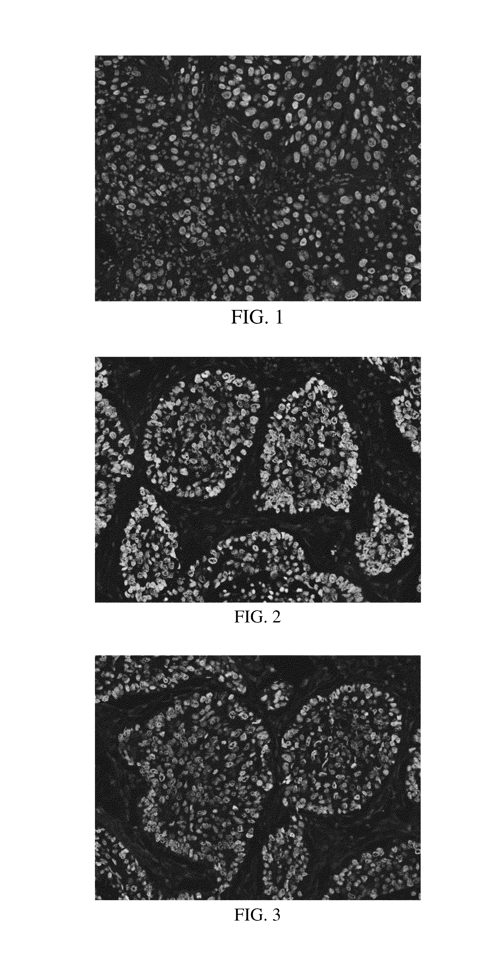 Anti-p40 antibodies systems and methods