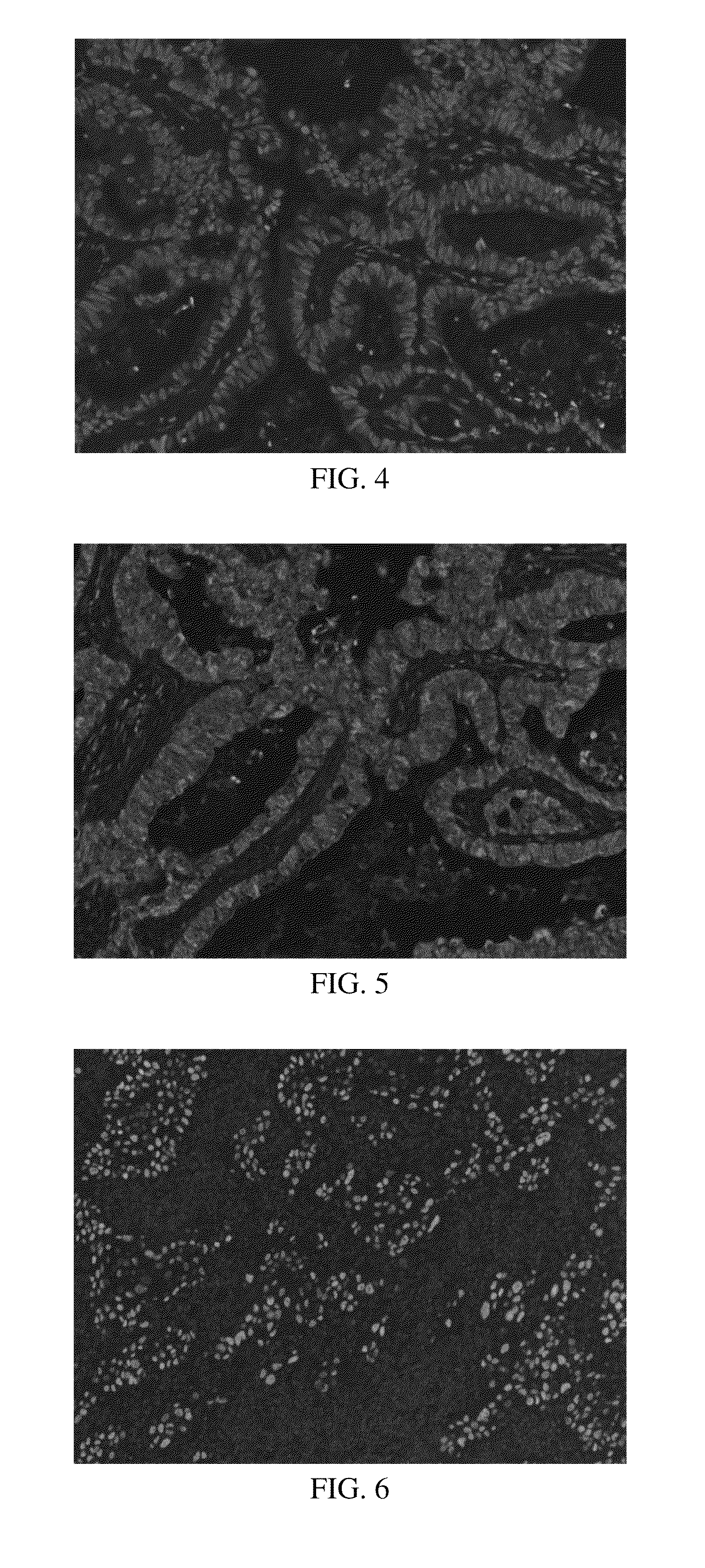 Anti-p40 antibodies systems and methods