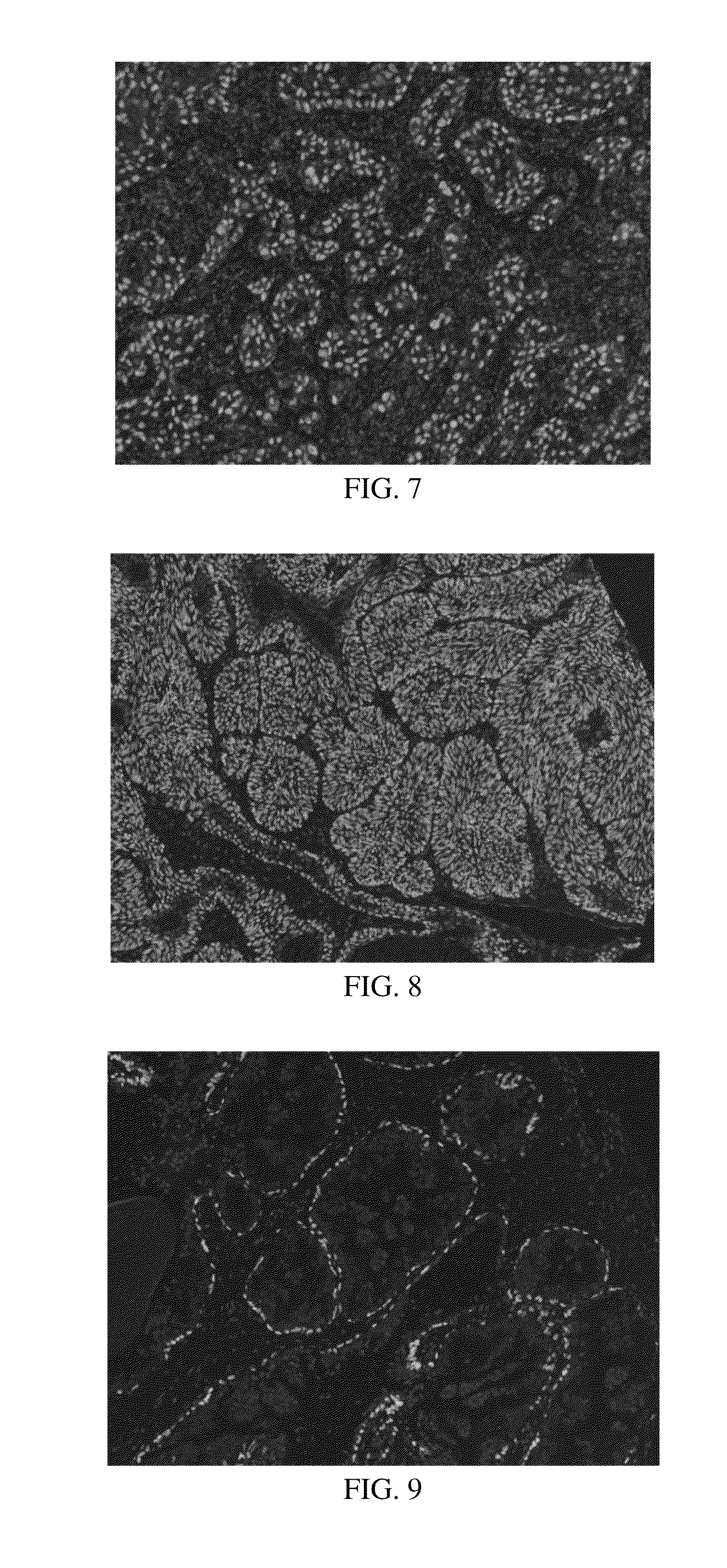 Anti-p40 antibodies systems and methods