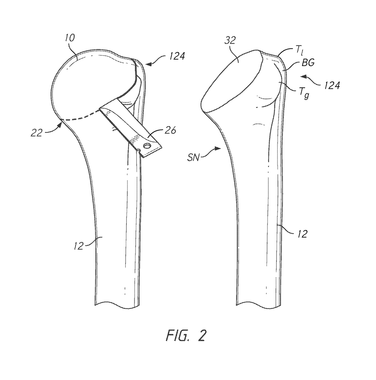 Patient specific humeral cutting guides