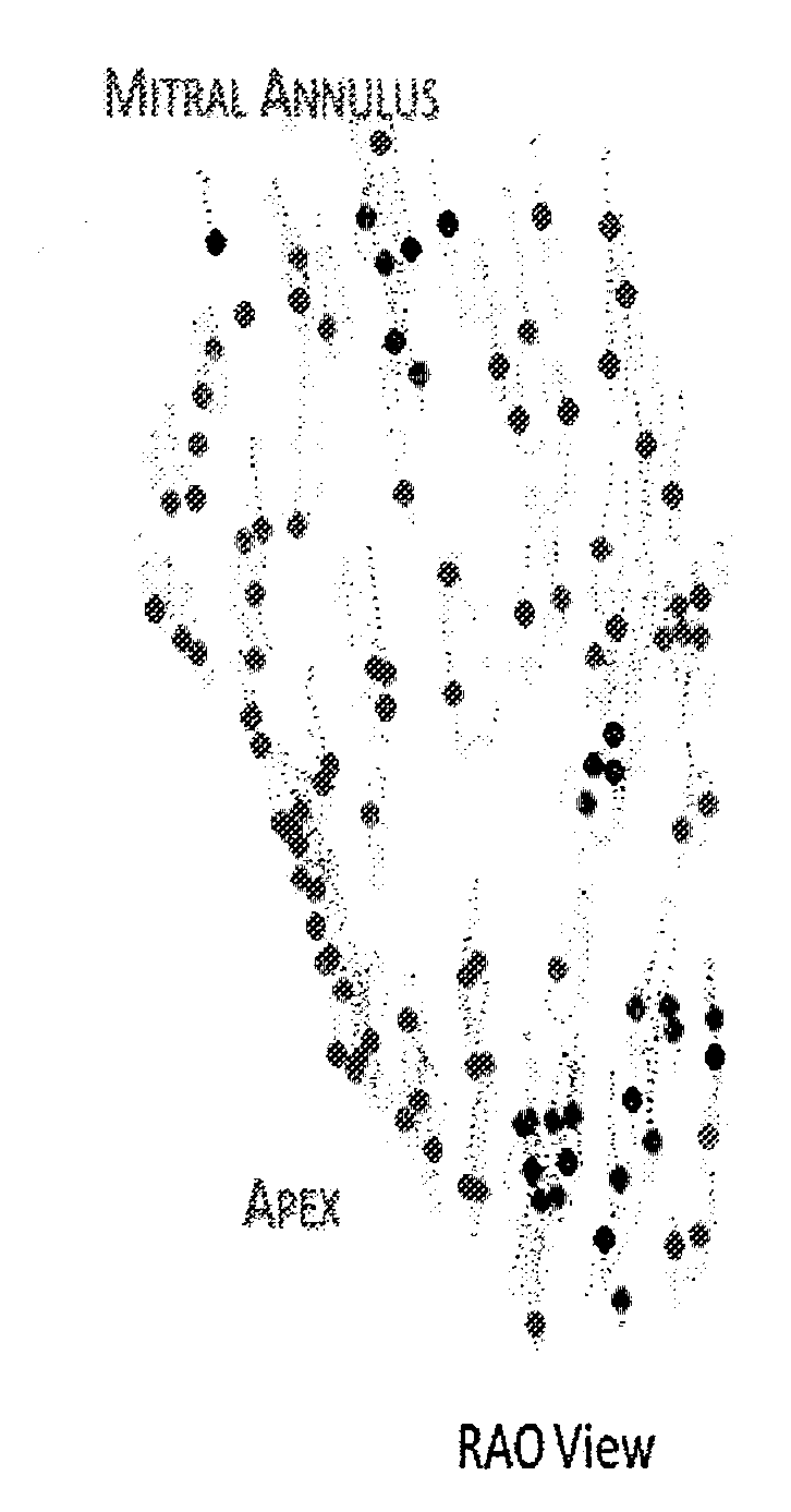 Method and system to automatically assign map points to anatomical segments and determine mechanical activation time