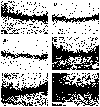 A kind of pharmaceutical composition for treating Alzheimer's disease