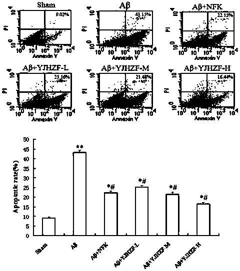 A kind of pharmaceutical composition for treating Alzheimer's disease