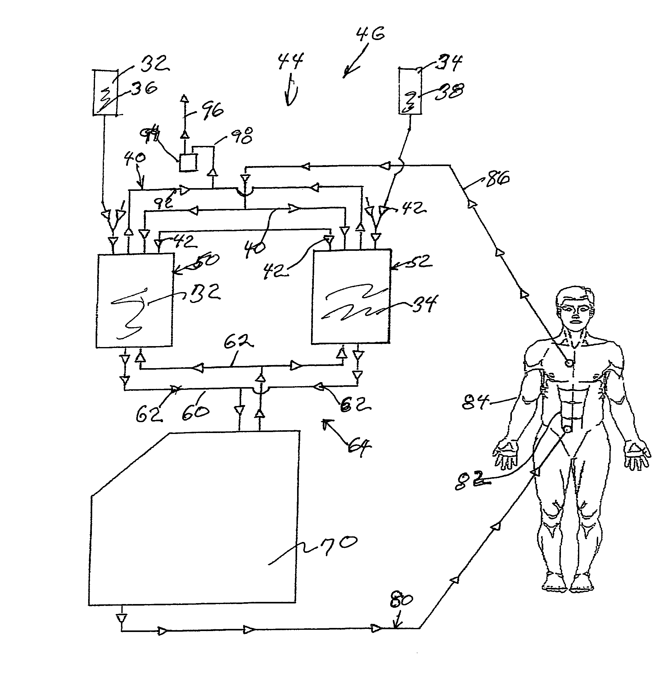 Hyperthermia, system, method and components