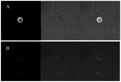 Protoplast preparation and genetic transformation method of Chinese cabbage