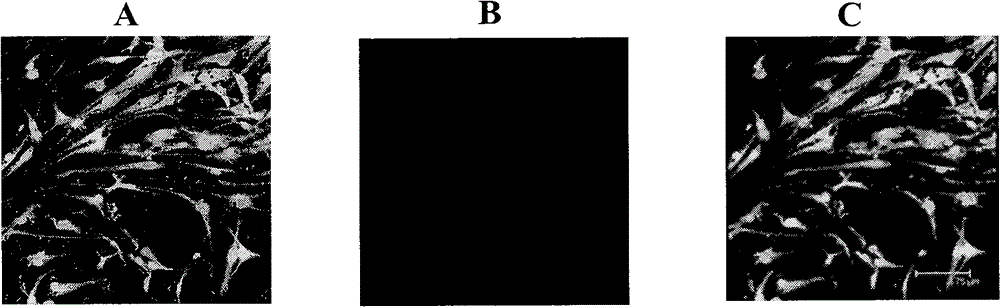 Neural stem cell capable of self-renewing, preparation method and application thereof