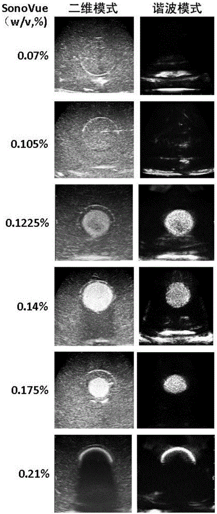 Simulator model used for simulating tumor ultrasonic radiography